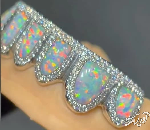 گارد دندان الماس کیم کارداشیان گارد دندان